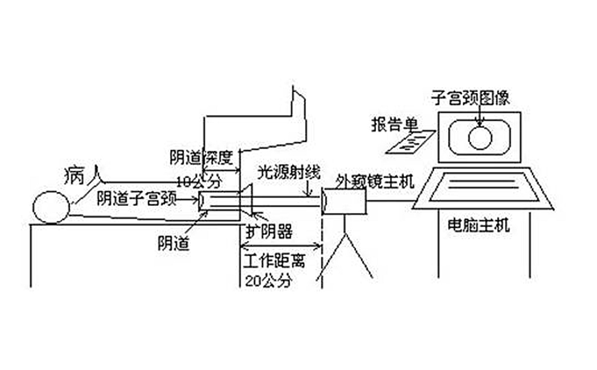 如何使用数码电子阴道镜?