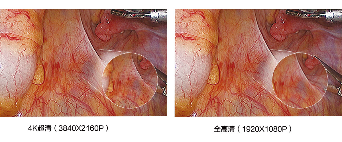 益柯达4K超高清内窥镜摄像系统