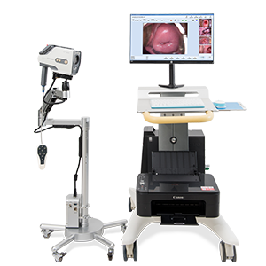 数码电子阴道镜解决方案