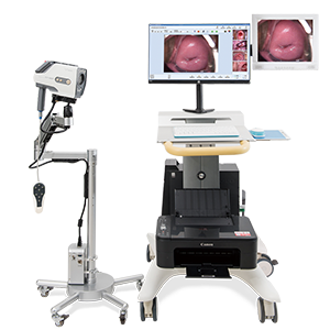 数码电子阴道镜解决方案