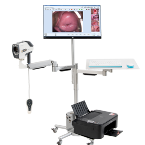 数码电子阴道镜解决方案