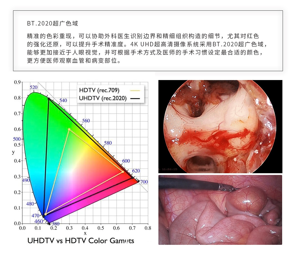 【4K医用内窥镜摄像系统】您的第一台“4K”找到了吗？