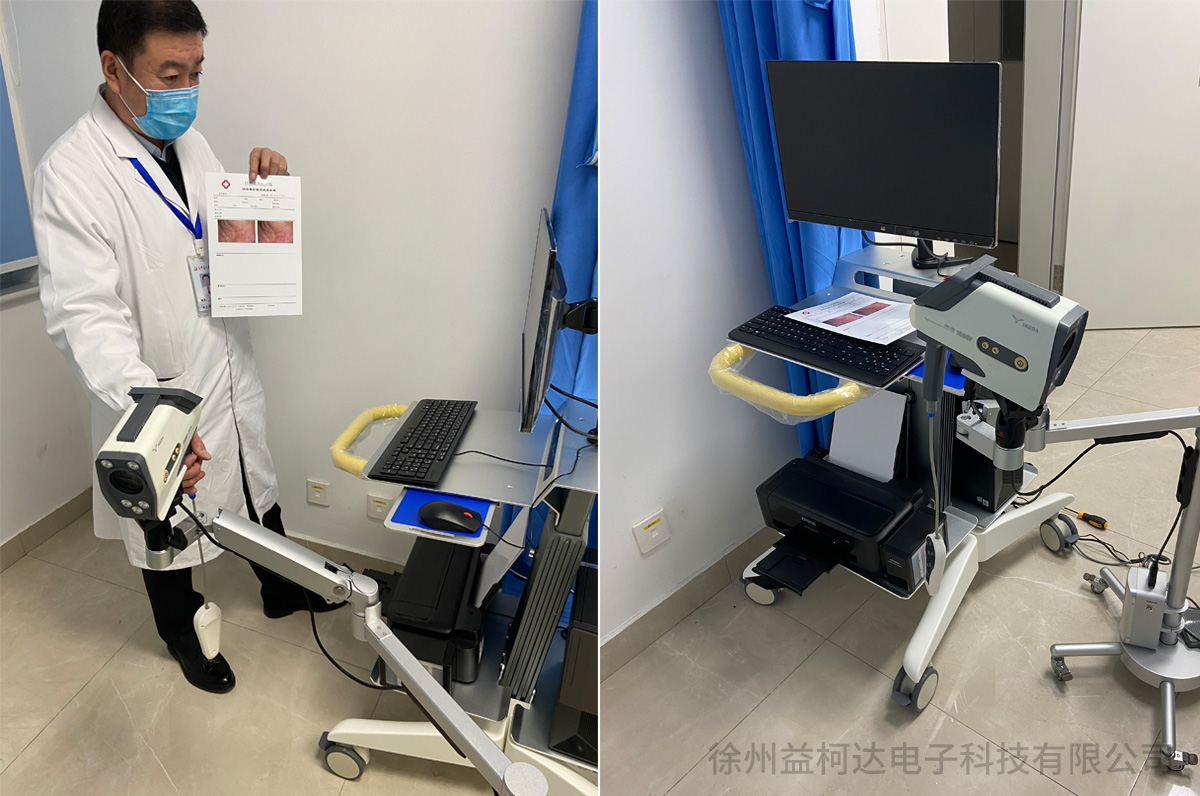 益柯达高清数码电子阴道镜装机