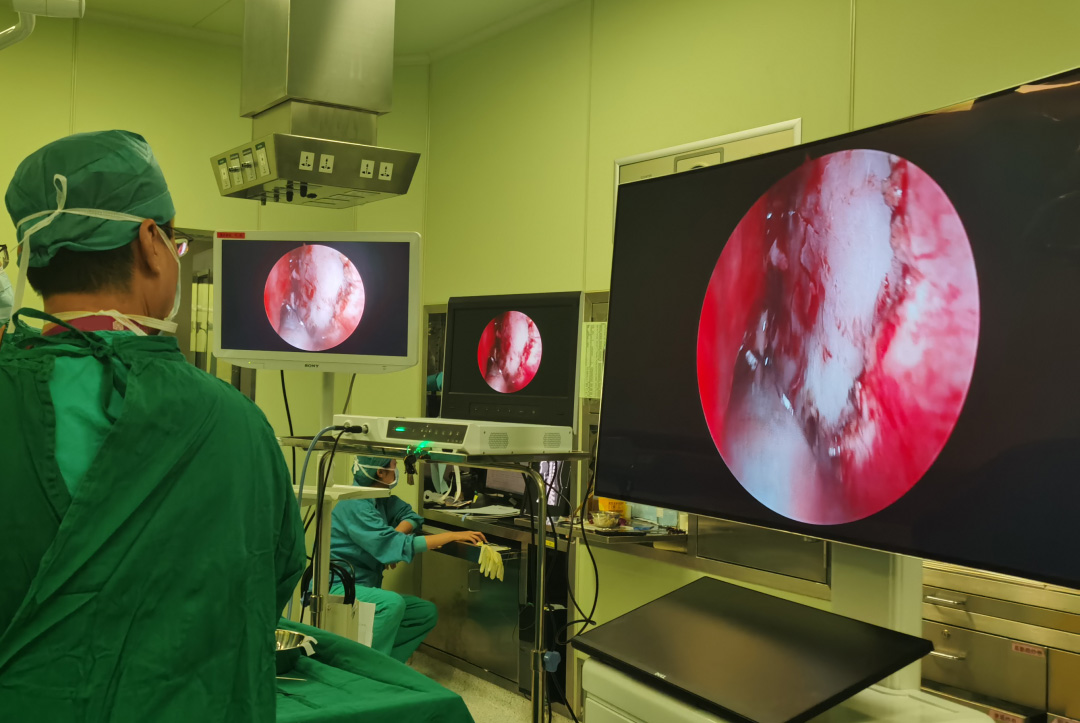 在神经外科，应该如何选择内窥镜摄像系统？