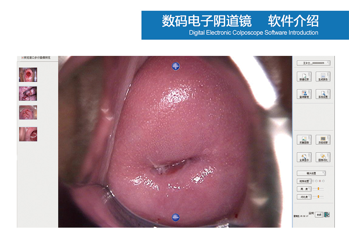 益柯达数码电子阴道镜打包发货