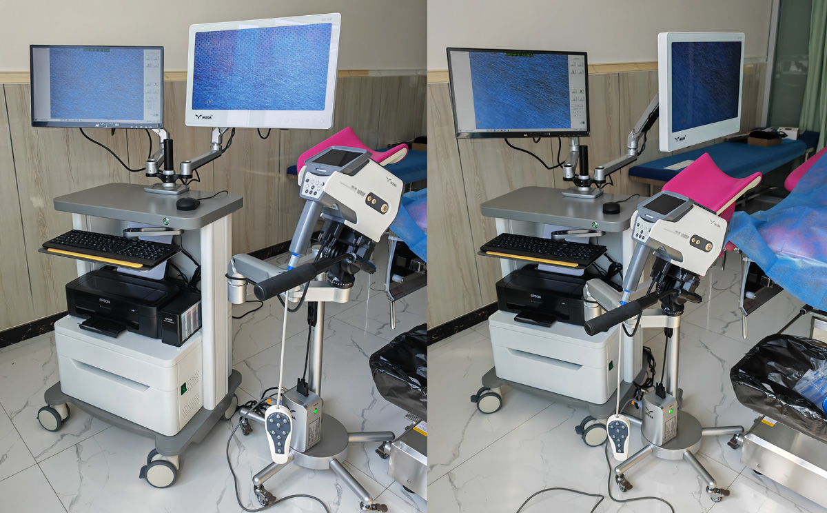 益柯达数码电子阴道镜（双屏）装机
