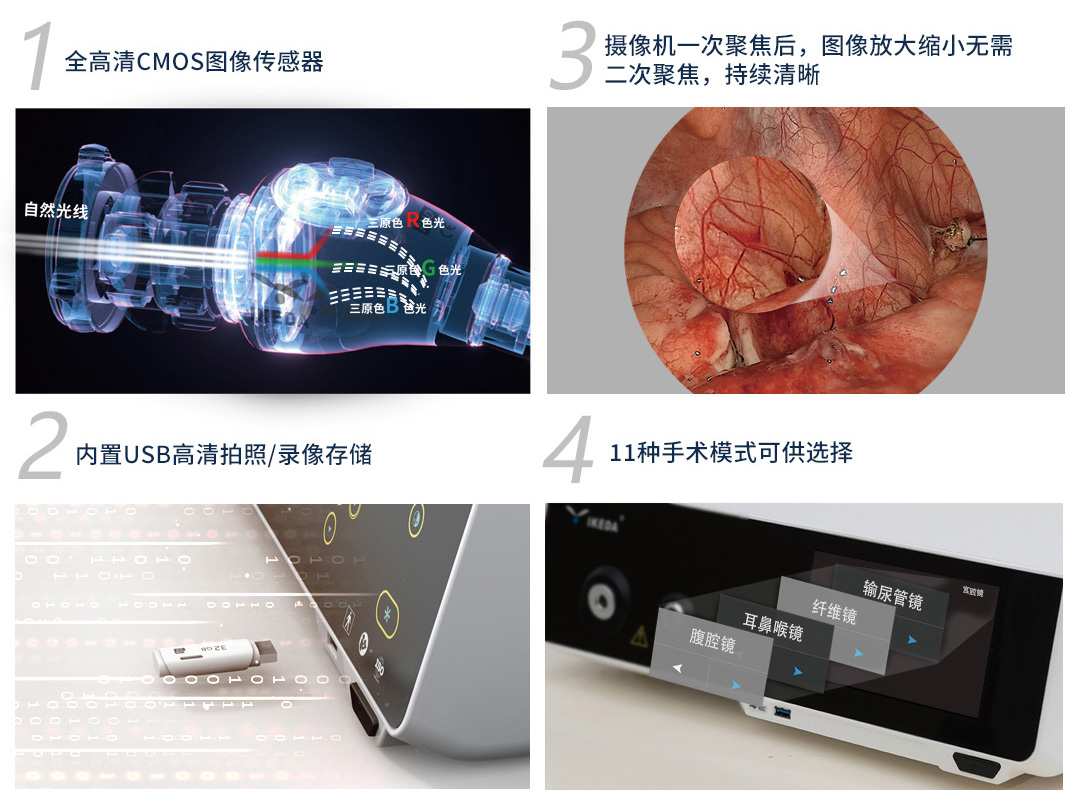 一体化内窥镜影像系统 YKD-9101