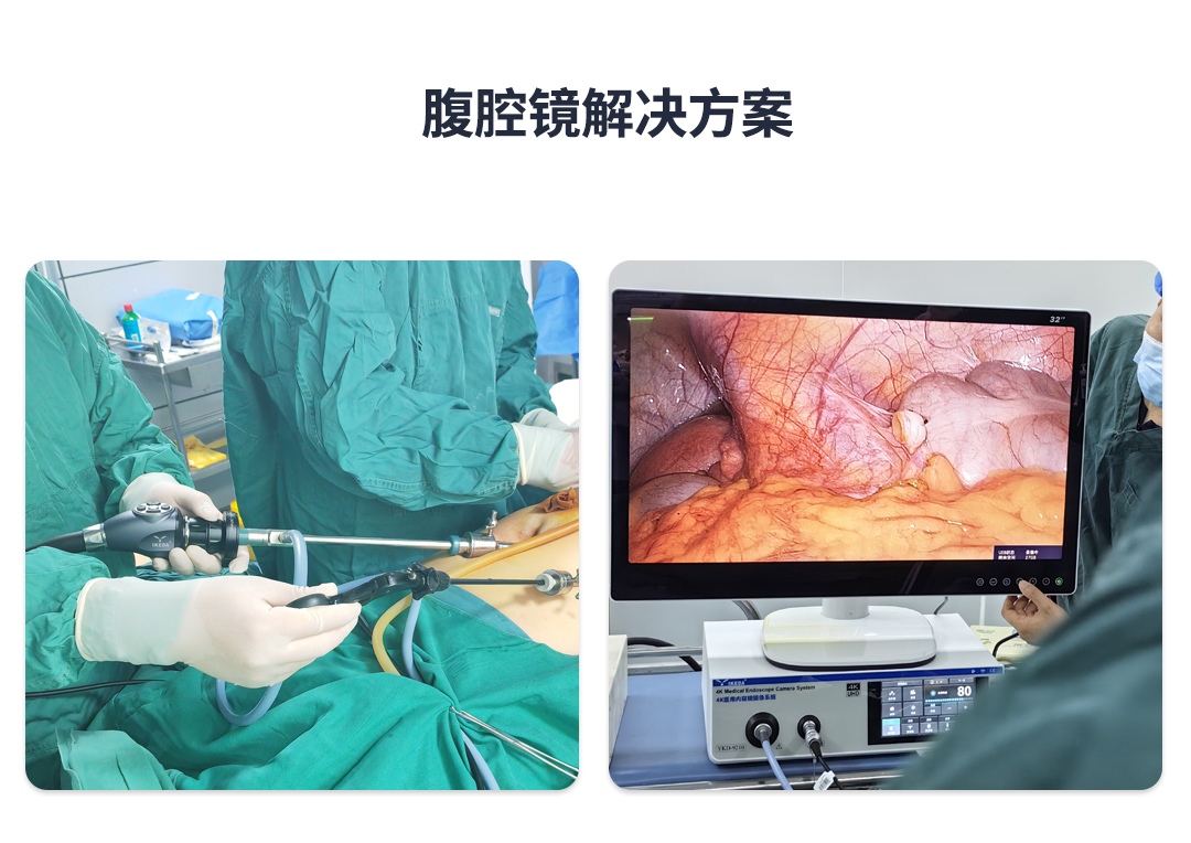腹腔镜解决方案