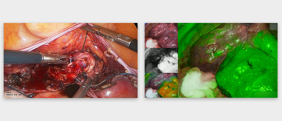 4K荧光内窥镜摄像系统