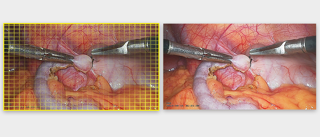 4K荧光内窥镜摄像系统