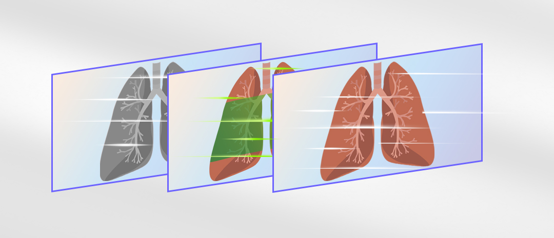 4K荧光内窥镜摄像系统