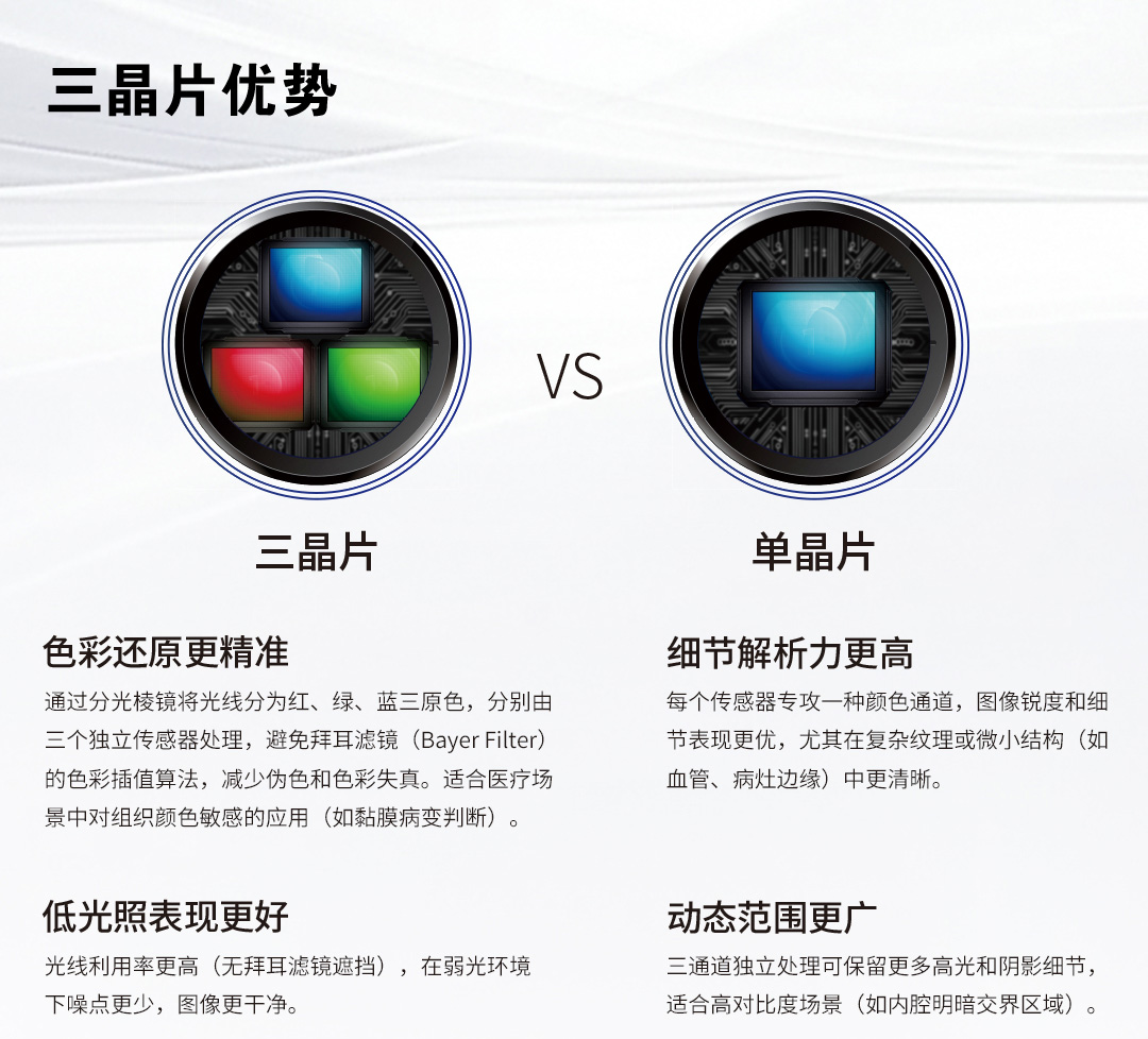 三晶片内窥镜摄像系统