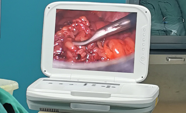 腹腔镜摄像系统的基本组成
