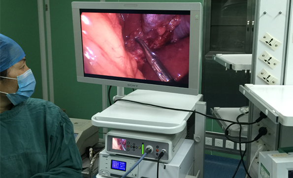 使用腹腔镜注意事项