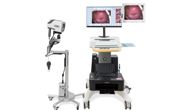 阴道镜选择：数码电子阴道镜和传统阴道镜的区别