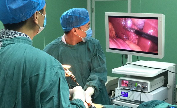 腹腔镜手术的操作方法以及注意事项