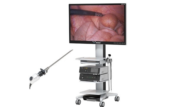 4K腹腔镜系统技术适应症以及优势