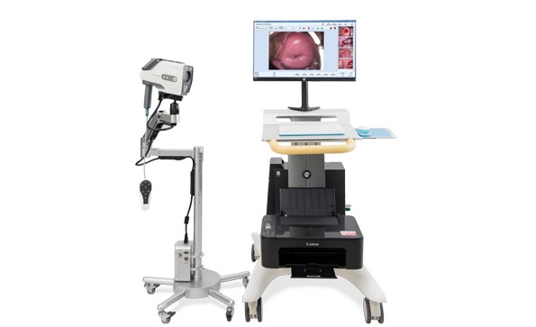 数码电子阴道镜在宫颈疾病中的应用