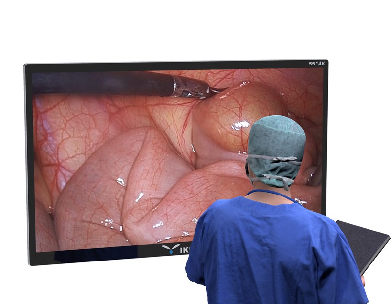 55寸4K医用监视器